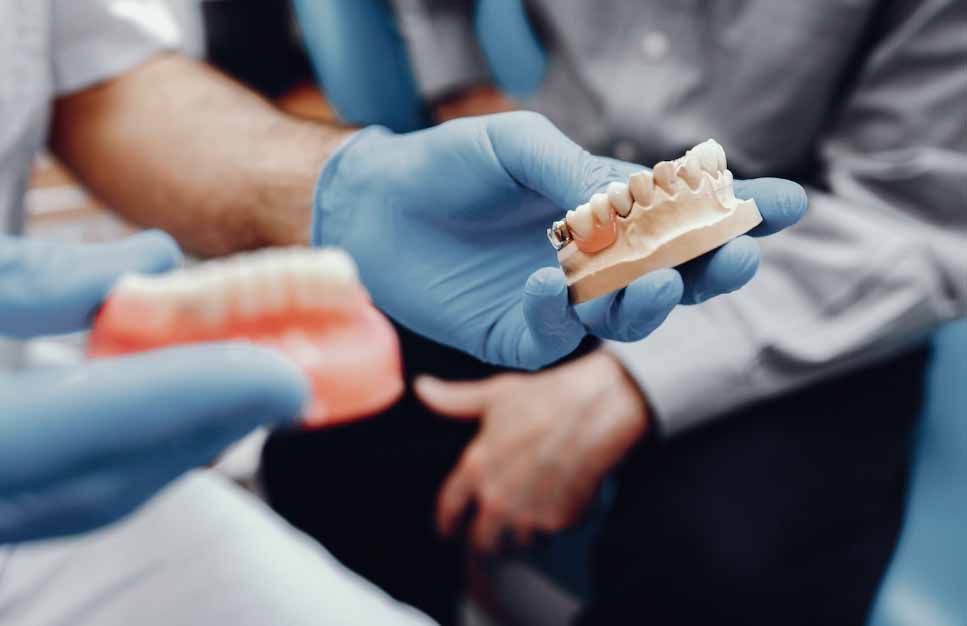 que es un pontico dental y que tipos existen