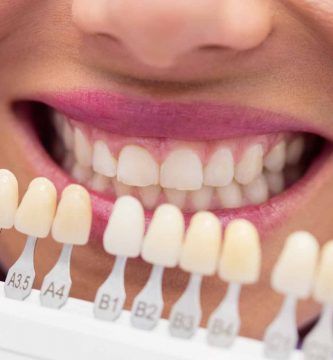 corona dental