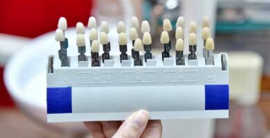 mini implantes dentales para protesis total